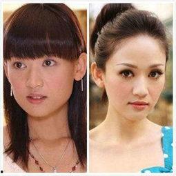 明星怎样隆鼻,从自然到精致，探寻美丽蜕变之路